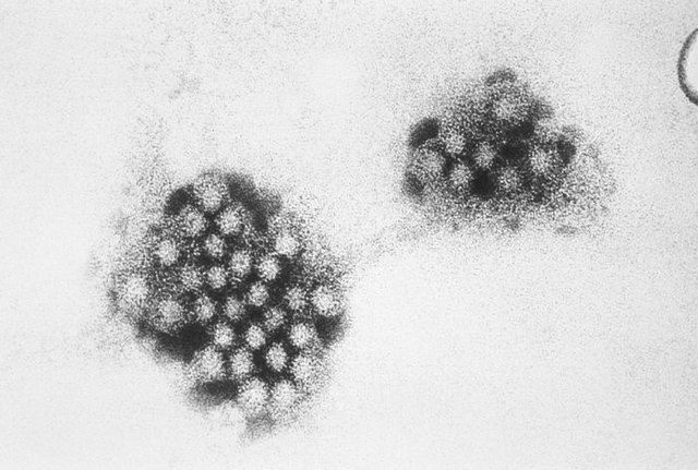 norovirus au Japon